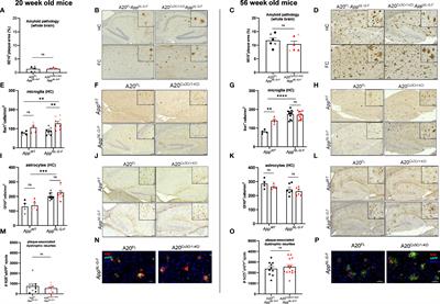 Inflammasome signaling is dispensable for ß-amyloid-induced neuropathology in preclinical models of Alzheimer’s disease